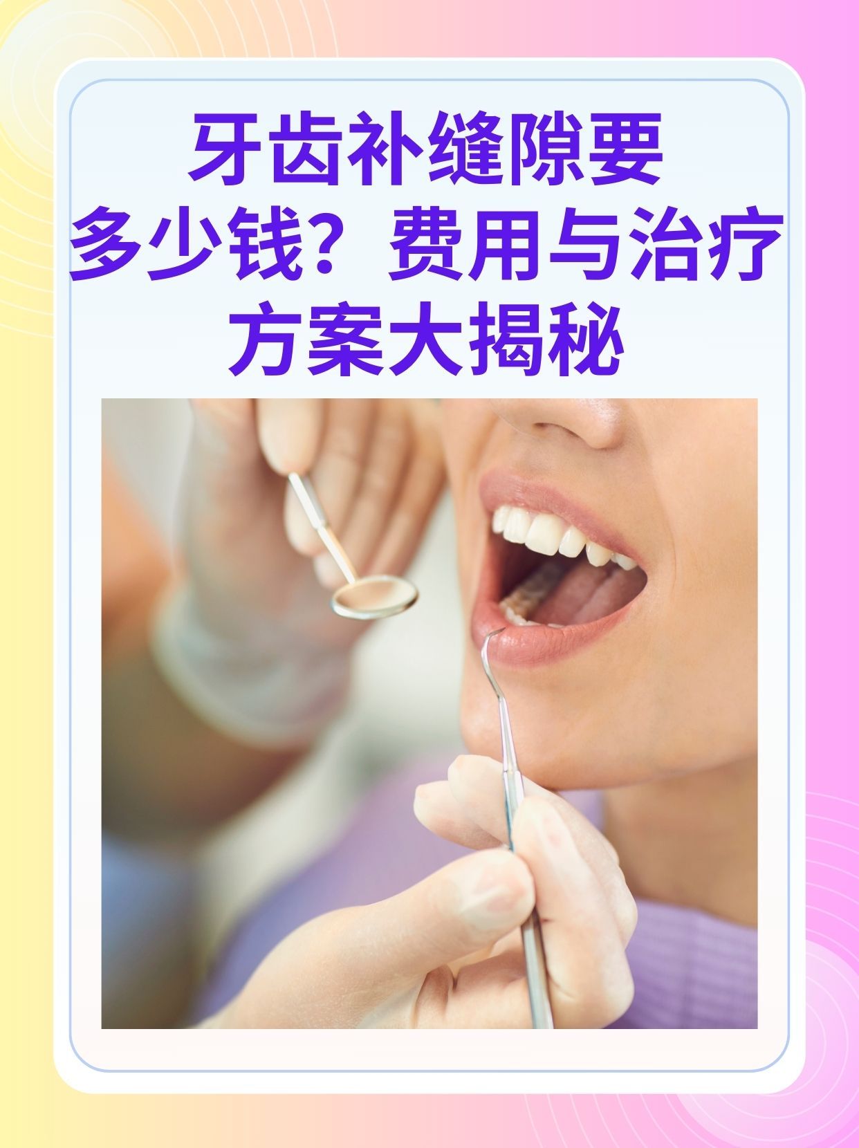 乐山补牙医保可以报销吗(补牙医保可以报销吗 哪些可以报销呢)